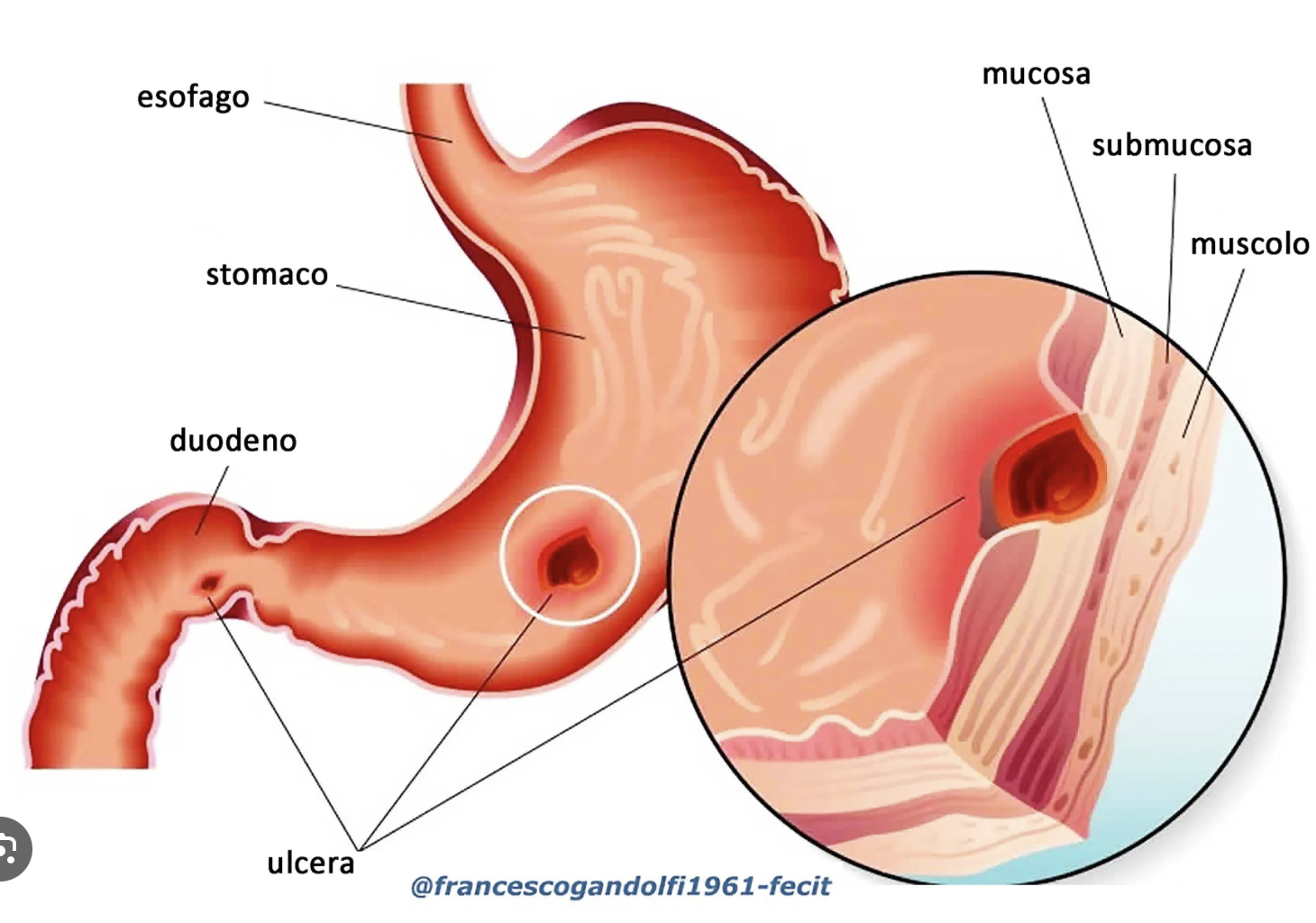 Umberto Rotta Effetto dell'elettroagopuntura sulla riparazione delle lesioni da ...
